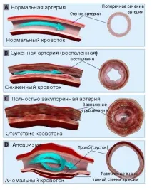 признаци