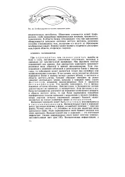 Хоріоїдит - Велика Енциклопедія Нафти та Газа, стаття, сторінка 1 газа
