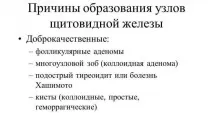 Аденома щитовидної залози - що це таке, симптоми та лікування лікування