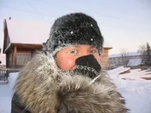 Алергія на холод на обличчі, щоках та очах фото симптомів та лікування щоках