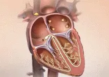 E-Cardio Фібриляція передсердь фібриляція