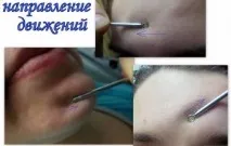 Як видавлювати чорні крапки чорні