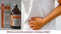 Лікування та застосування АСД фракції 2 при гастриті застосування