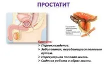 Чи можна вилікувати хронічний простатит? можна