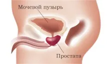 Чи можна вилікувати хронічний простатит? хронічний