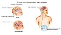 зовнішня