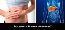 Ускладнення жовчнокам’яної хвороби симптоми, лікування хвороби