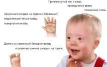 Патологія вагітності дитини