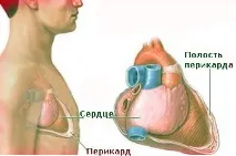 Чому болить серце, причини та лікування болю в області серця серце