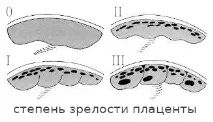 Передчасне старіння плаценти чим небезпечно. плаценти