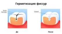 проблеми