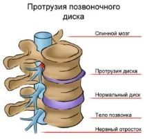 междупрешленния