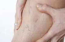 ретикулярний