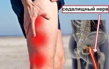 ішіасу