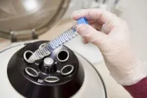 Скільки живуть сперматозоїди у піхві, на повітрі, у матці сперматозоїди