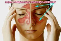 Снуп дитячий під час вагітності вагітності