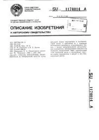 Спосіб ендопротезування методіафізарної частини трубчастої кістки методіафізарної