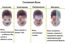 Спазмалгон від головного болю ефективність, інструкція із застосування таблеток ефективність