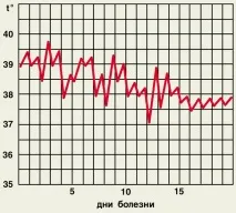 Температурні криві при різних типах лихоманки криві