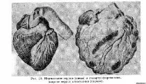 Урок 20-й кров