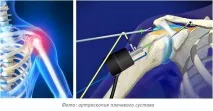 Артроскопія суглобів Єкатеринбург, Ціни та вартість операції на колінних суглобах, «Преображенська артроскопія