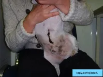 гірудотерапії