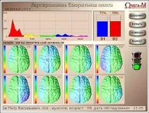 Цифровий аналізатор біоритмів Омега-м (омега-медицина) - Клінічний медичний багатопрофільний цифровий
