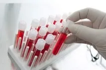 Фібриноген що це і для чого він потрібен фібриноген
