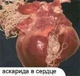 гельмінтів