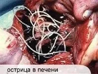 гельмінти