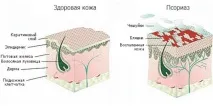 Червоні плями на головці члена причини та методи діагностики червоні