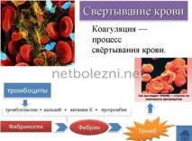 Дрібні червоні крапки на тілі як родимки, причини появи тілі