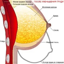 nissamed