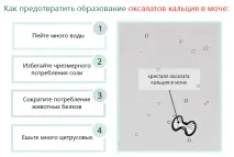 Освіта оксалатів кальцію в сечі - що це означає сечі