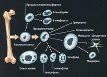 Причини анемії у подробицях анемії
