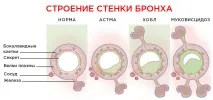 Ридає дихання при діабеті техніка виконання та відгуки ридає