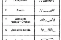 Ридає дихання при діабеті техніка виконання та відгуки ридає