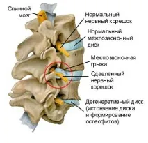 шейного