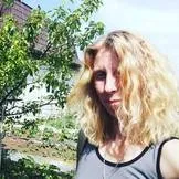 Синдром ошпареної шкіри ошпареної
