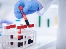 Скринінг при вагітності терміни проведення, норма скринінг