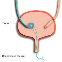 употреба