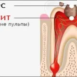 точки