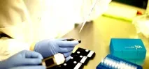 Рівень ПСА після радикальної простатектоміїчерез рік і через кілька років 2019 рівень