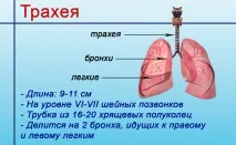 Види трахеїту – вірусний та бактеріальний, гнійний та затяжний та ін. гнійний