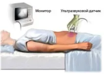 внутрішніх органів порожнини