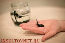 Профілактика інсульту японська софора та п’явки софора