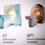 Астроцитома головного мозку причини, симптоми, прогноз причини
