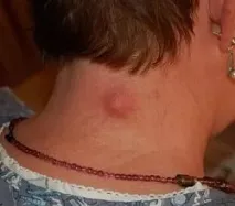 операції