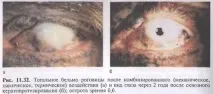 операції