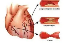 новородени